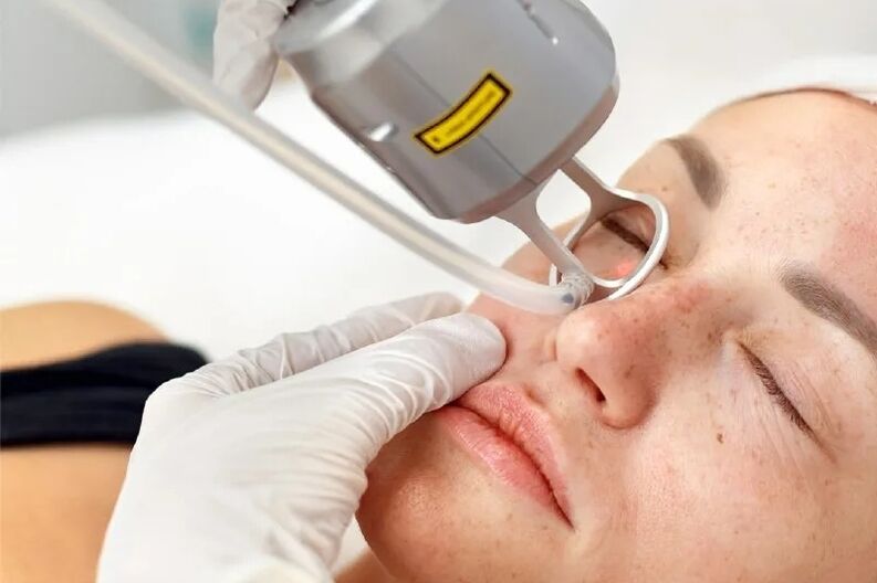 Plateforme laser pour la correction de la peau du visage